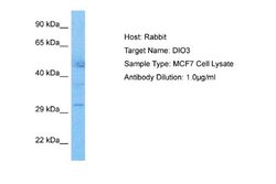 DIO3 Rabbit anti-Human, Polyclonal, Novus Biologicals 0.1ml; Unconjugated:Antibodies,